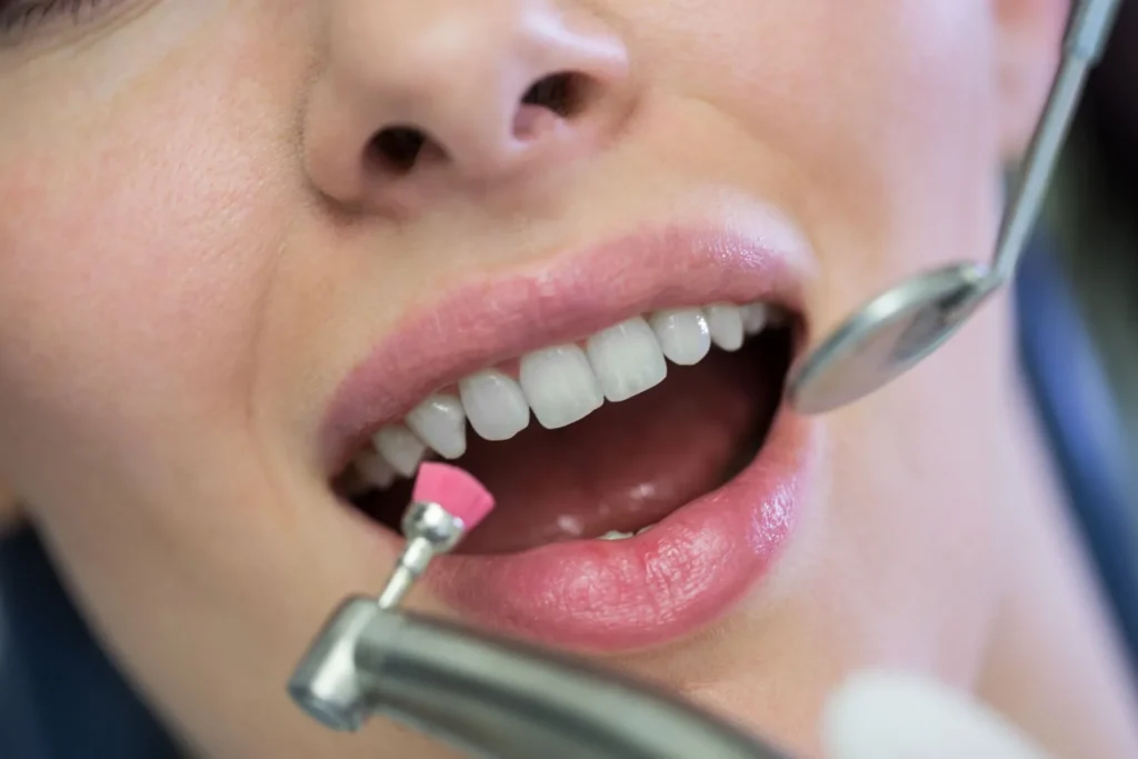 Igiene dentale a Pomezia